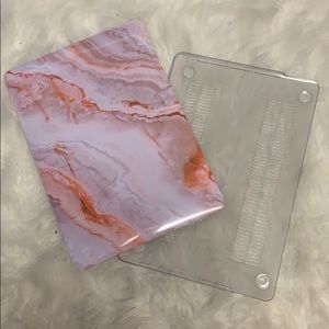 Marble Macbook Air 11’ Hard Case